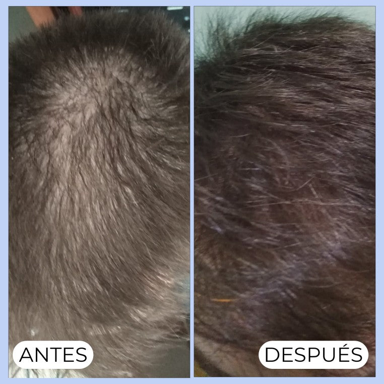 ALMA SECRET Shikakai - Shampooing antichute & antipelliculaire – Image 4